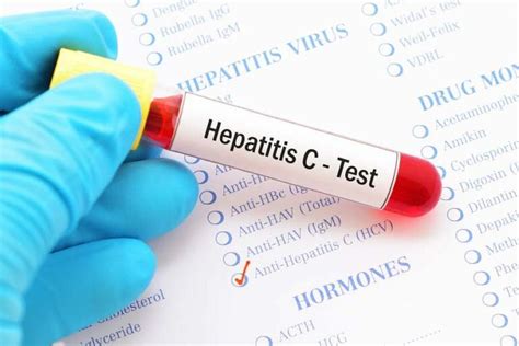 what does 0.1 mean on a hep c test|Hepatitis C Blood Test: Results, Cost, and More .